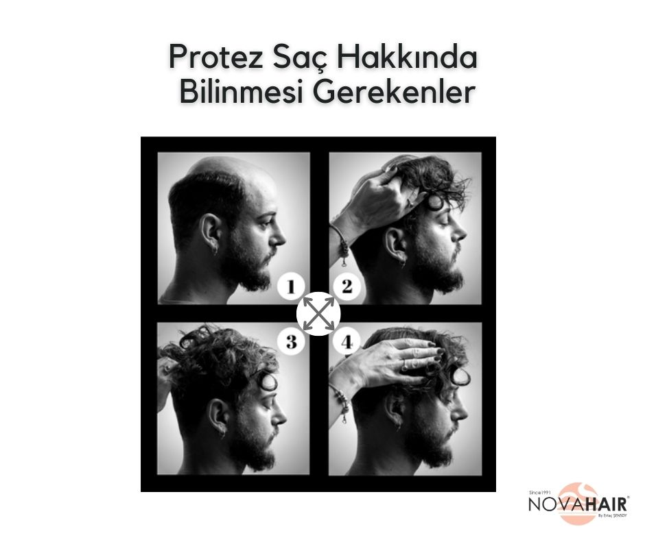 Protez saç hakkında bilinmesi gerekenler